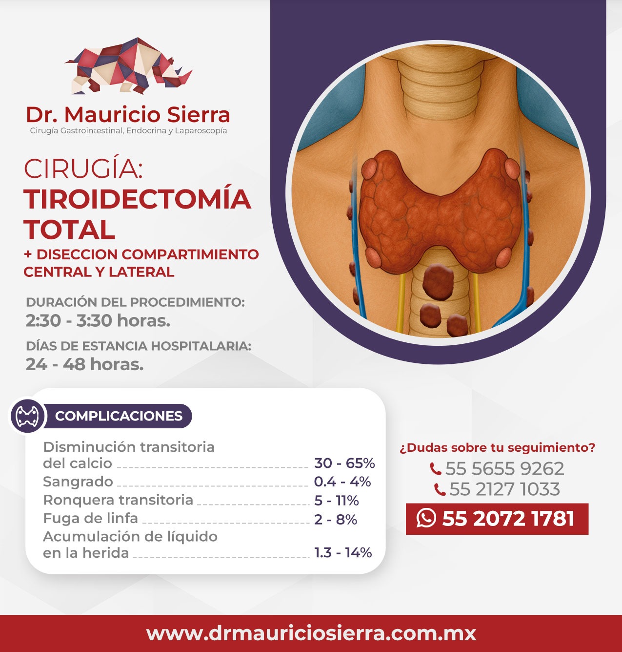 tiroidectomia + diseccion central-lateral