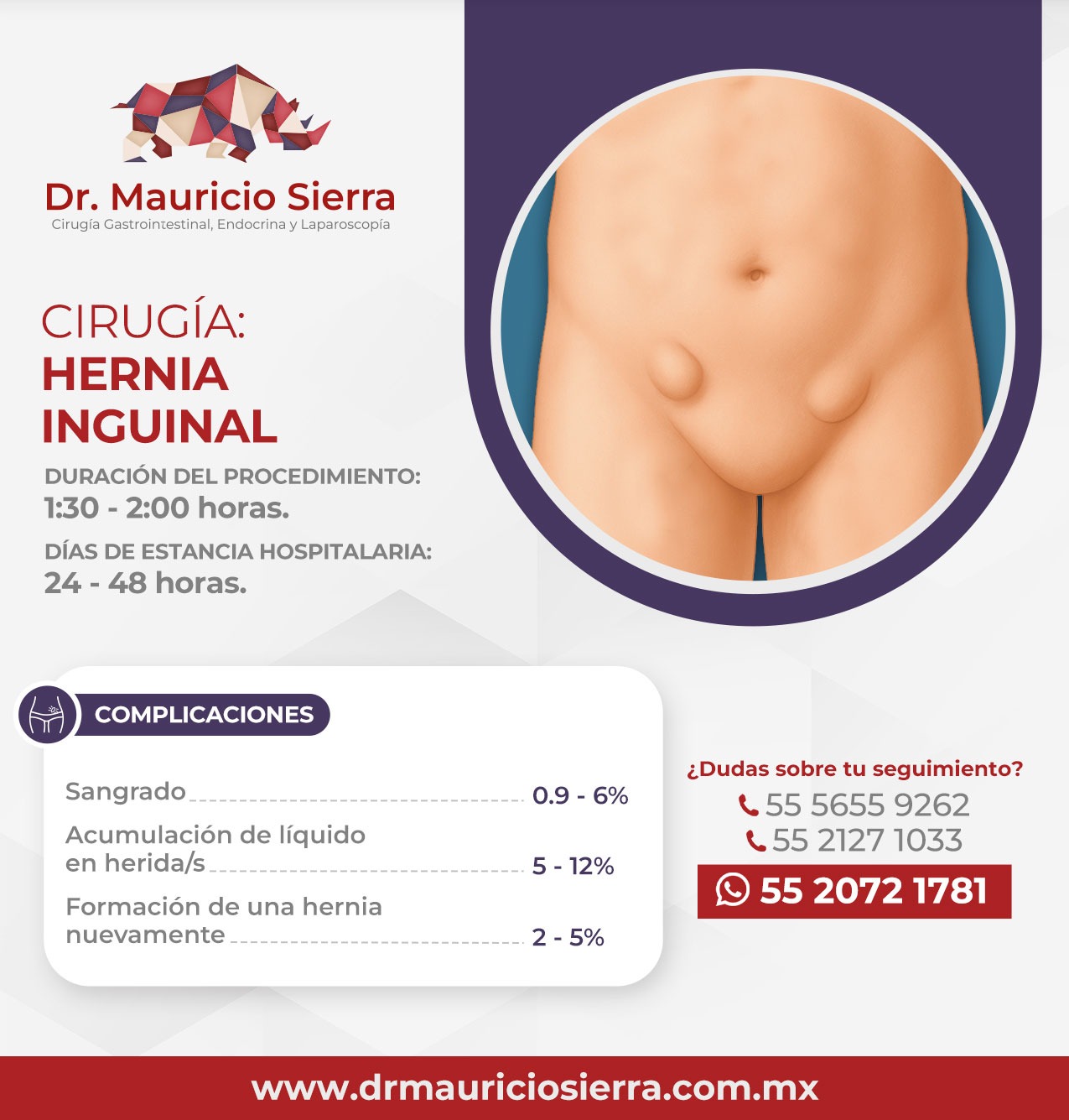 hernia hinguinal